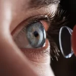 Contact Lenses